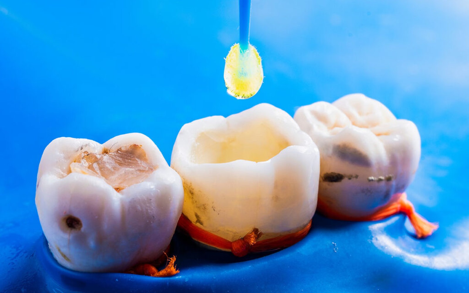 Dental Air Purification System Financing