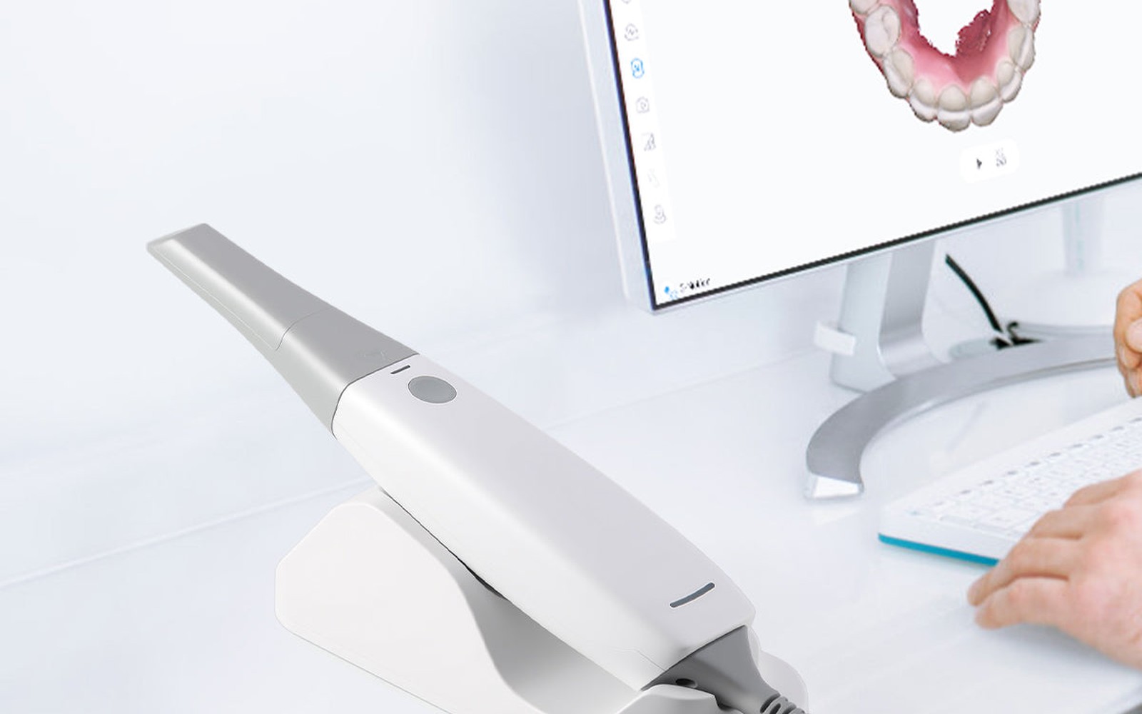 Intraoral Scanner Financing