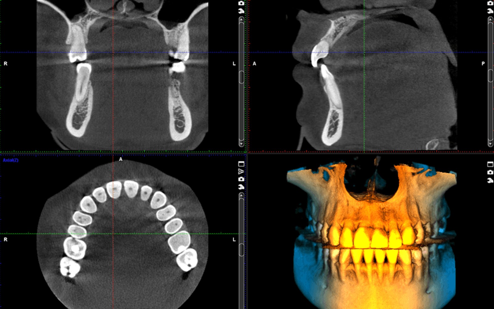 Planmeca ProMax 3D CBCT Financing